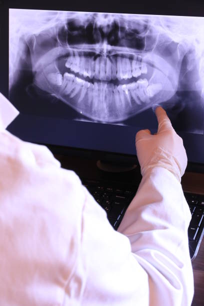 Best Emergency Dentist for Knocked-Out Tooth in Harris Hill, NY