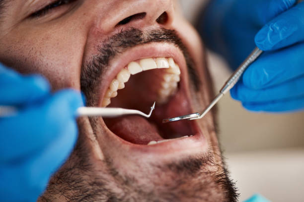 Best Pediatric Emergency Dentist in Harris Hill, NY